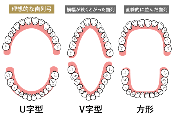 綺麗なU字型アーチ